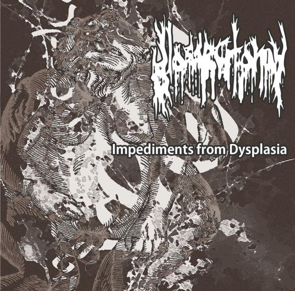 Glossectomy  - Impediments From Dysplasia (EP)
