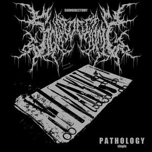 Sigmoidectomy - Discography (2014 - 2020)