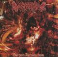 Leprosy - Beyond Recognition