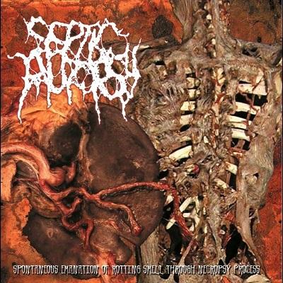 Septic Autopsy - Discography (2011 - 2018)