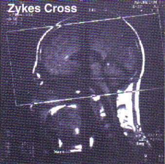 Zykes Cross - Altered States