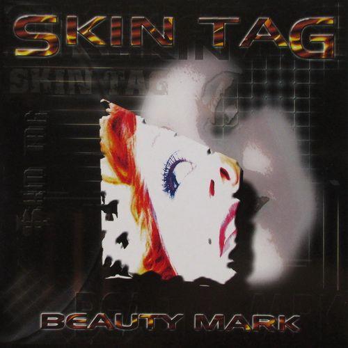 Skin Tag - Beauty Mark