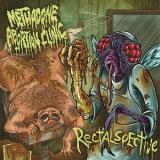 Methadone Abortion Clinic - Rectalspective (Compilation)