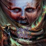 Parasites &amp; Plagues - The Human Condition (Upconvert)