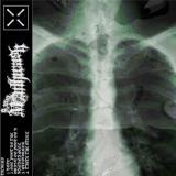 9mm Mouthwash - 9mm Mouthwash (EP)