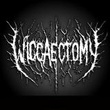Wiggaectomy - Discography (2025 - 2026)